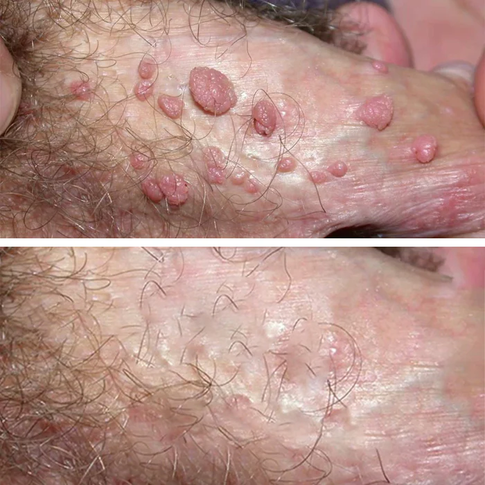 Customer holding ClariDerm after switching from a broad topical routine